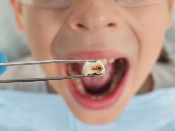 Best After-Hours Emergency Dentist in Greenbrier, AR